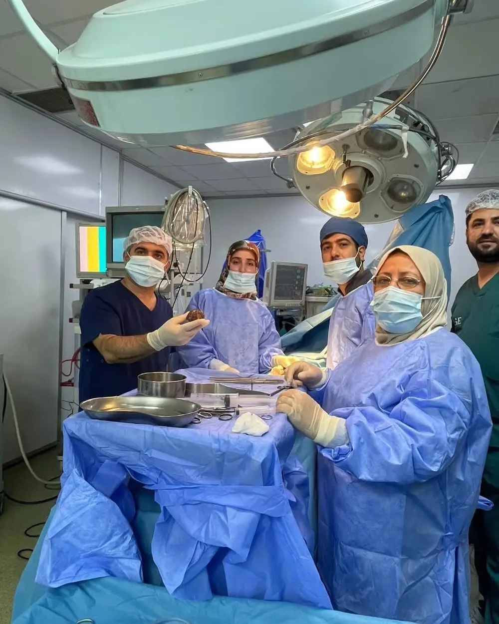 Erbil'de bir hastanın mesanesinden ameliyatla dev taş çıkarıldı