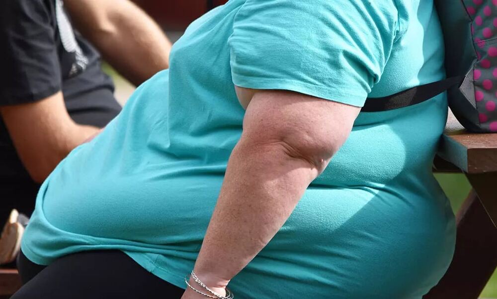 Obezite Uyku Apnesi Riskini Artırıyor: Nefes Durdurulabiliyor